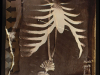 Kathy Vargas (b. 1950, San Antonio), Oración: Valentine’s Day / Day of the Dead [Rib Cage], ca. 1989–90, gelatin silver print with hand-coloring, 24x20 in. Vargas writes, “This series began as a remembrance of friends who recently died of AIDS.”