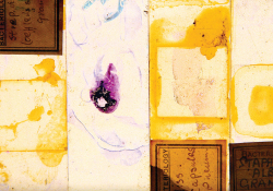 A collage combining old bacterial slides with other mixed media, organized in rectangles